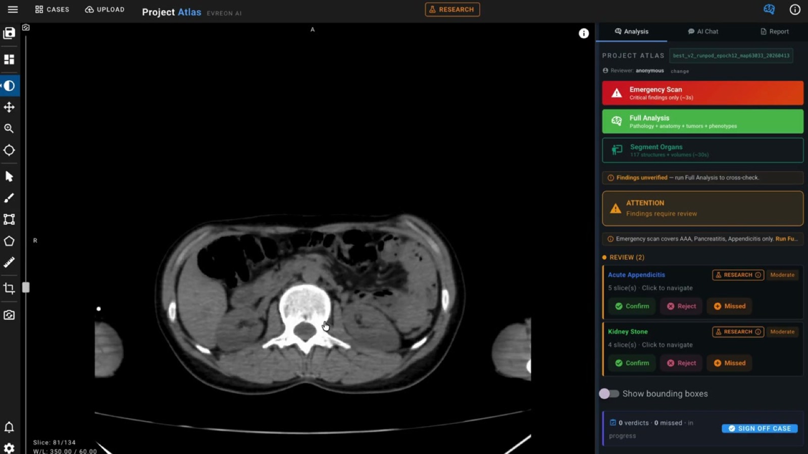 Abdominal CT review interface with localized findings